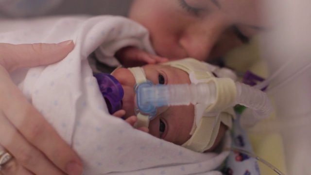 A Premature Baby's First Year On Earth - Amazing VIDEO