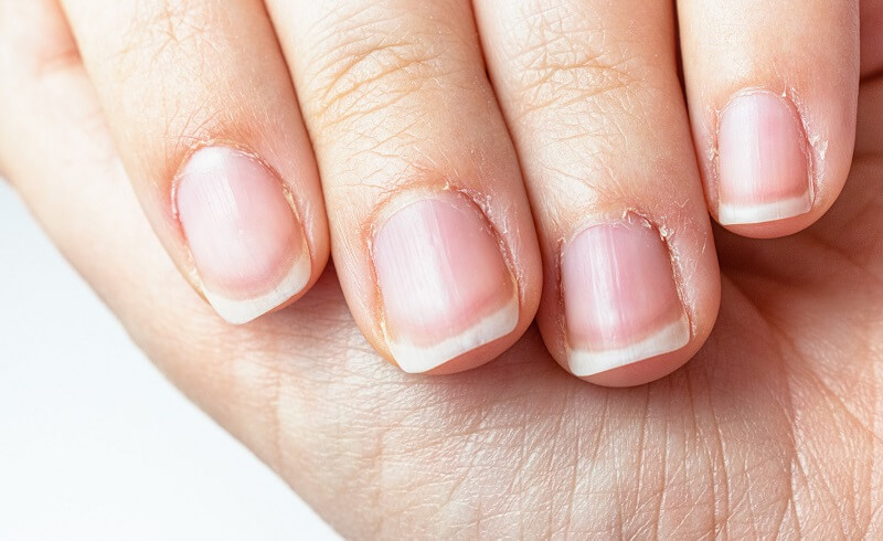 What causes the skin around the nails to break and why is it so painful?